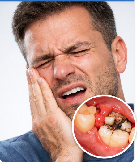 Before treatment image highlighting teeth discoloration and gaps